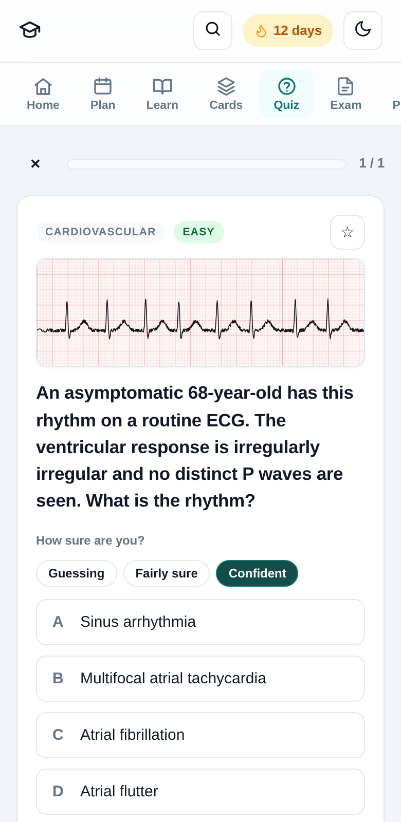NP Study Partner quiz showing an ECG rhythm-strip question with confidence rating
